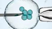 Qual é a posição da Igreja Católica sobre a fertilização in vitro?
