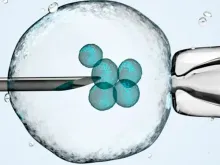 A Suprema Corte do estado do Alabama (EUA) decidiu que os embriões criados por meio de fertilização in vitro (FIV) são crianças humanas.