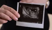 Conselho de bispos da Noruega critica projeto de permitir aborto até quinto mês de gravidez