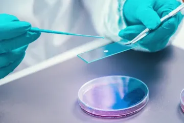 Invocell é uma variante da fertilização in vitro (imagem de referência)