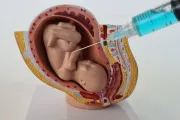 Imagem ilustrativa de uma assistolia fetal