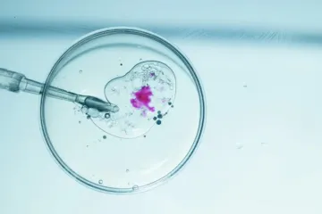 Fertilização in vitro
