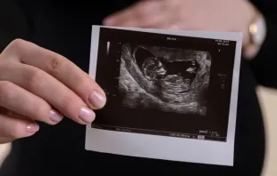 Ultrassom de bebê no ventre materno. Imagem referencial.