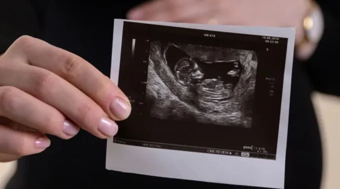 Ultrassom de bebê no ventre materno ?? 