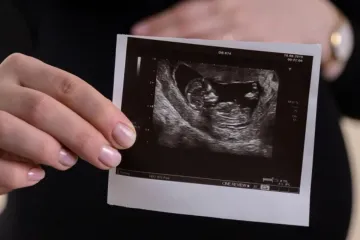 Ultrassom de bebê no ventre materno