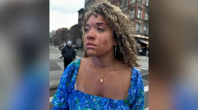 Savannah Craven Antao ?? 