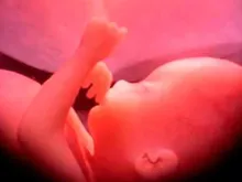 Nascituro. Imagem referencial.