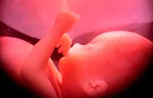 Nascituro. Imagem referencial.