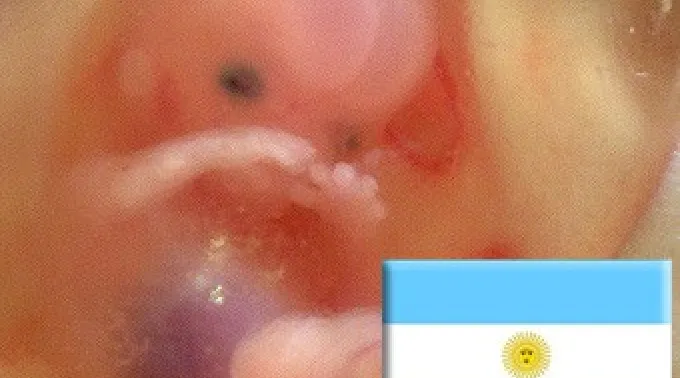 18_may_abortoargentina180512.jpg ?? 