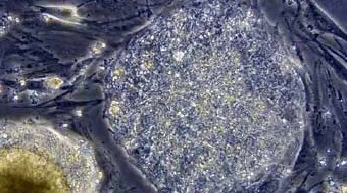 25_may_celulaspiel250512.jpg ?? 