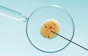 Fertilização in vitro. Foto: Shutterstock