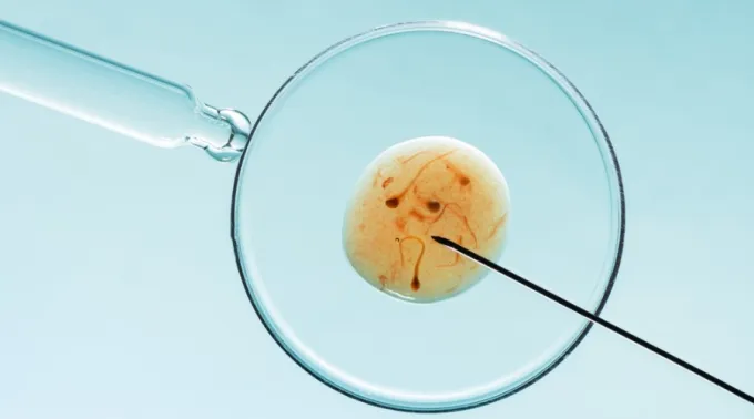 AAAshutterstock_2160051241.png ?? 