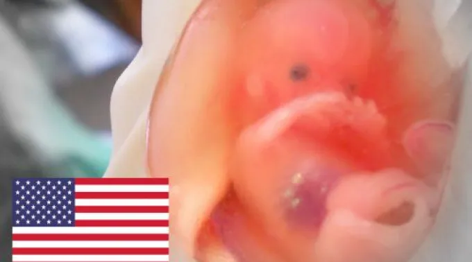 AbortoEstadosUnidos_AutorSuparnaSinha_CC-BY-SA-2.0.jpg ?? 