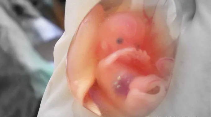 AbortoEstadosUnidos_WikimediaCommons_030119.jpg ?? 