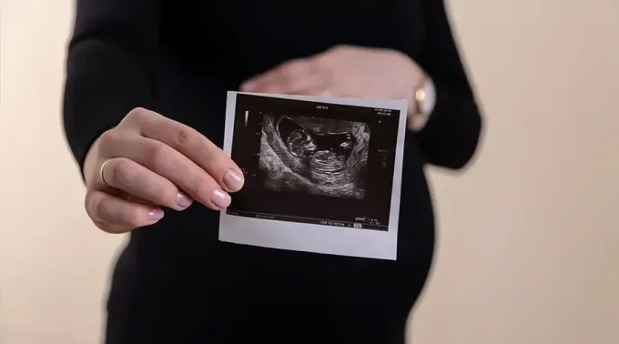 AbortoKentucky_020822.webp ?? 