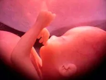 Bebê de 30 semanas de gestação. Crédito: Wikipédia, Ivon19 (CC-BY-SA-4.0)