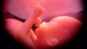 Conselho Federal de Medicina proíbe droga usada em aborto legal depois da 22ª semana