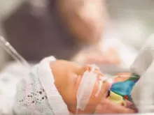 Imagem ilustrativa de bebê em unidade de cuidados intensivos