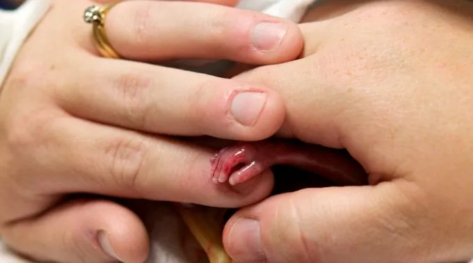 BebeFretz_LexyFretz_050315_1.jpg ?? 