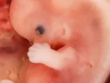 Embrião humano com 9 semanas de idade