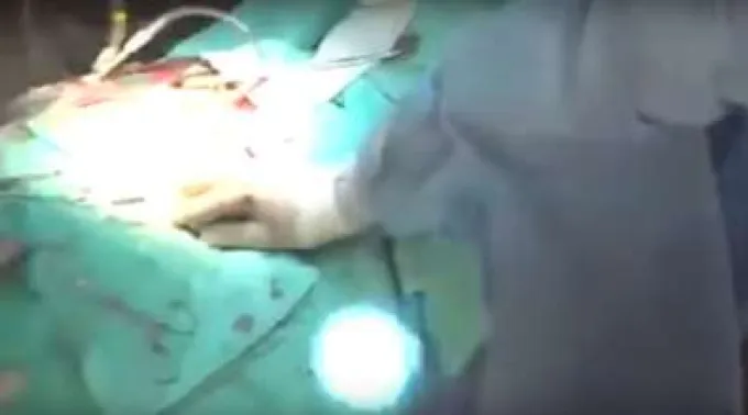 CirugiaMexico_YouTube_141017.jpg ?? 