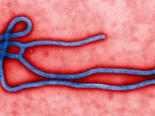 Vírus Ebola (Imagem Flickr The Global Panorama)
