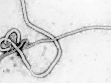 Vírus Ebola.