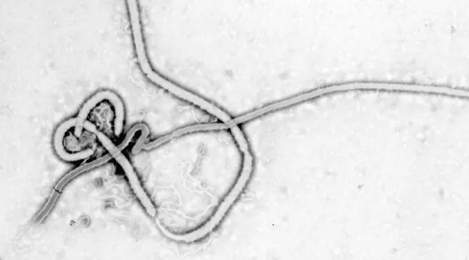 Ebola_Wikipedia_DominioPublico.jpg ?? 