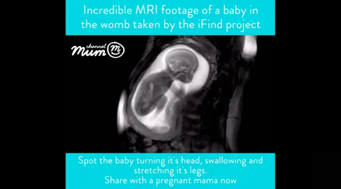 Ecografa_CapturaYoutube_100217.jpg ?? 