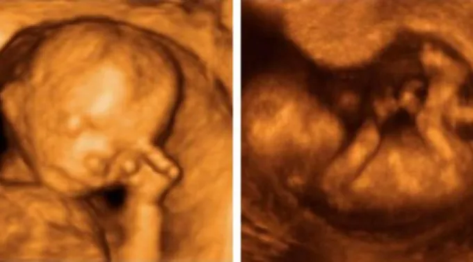 Ecografia4D_Autores-Madcapslaugh-Rizome_CC-BY-SA-3.0.jpg ?? 