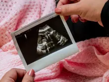 Mãe segura imagem de ultrassom de seu bebê
