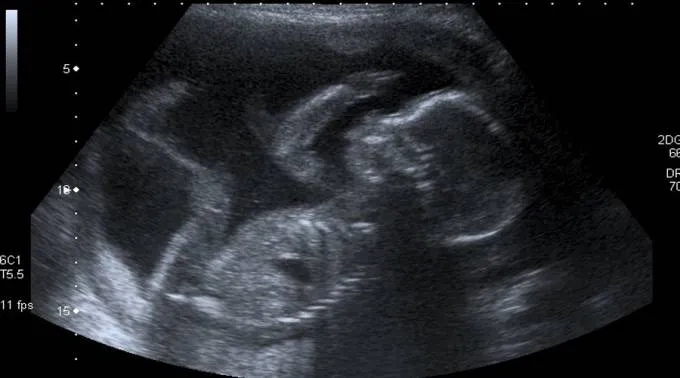 Ecografia_FlickrSteveCC_BY_NC_20_060116.jpg ?? 