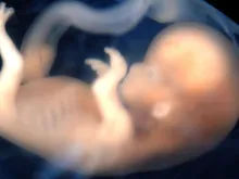Embrião de 9 a 10 semanas de vida - Imagem Flickr Lunar Caustic (CC-BY-SA-2.0)