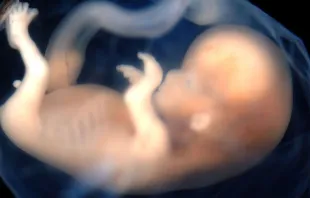 Embrião de 9-10 semanas de vida