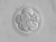 Embrião humano.