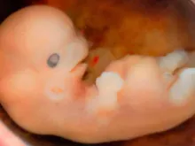 Embrião de 6 a 7 semanas