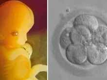 Embrião de 7 semanas e embrião de 8 células