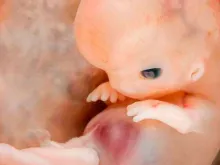 Embrião de 7 a 8 semanas