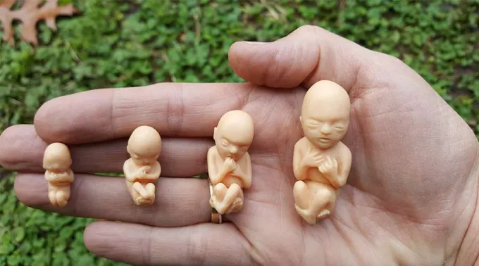 Fetos_MariaRodriguezVarela_101220.jpg ?? 