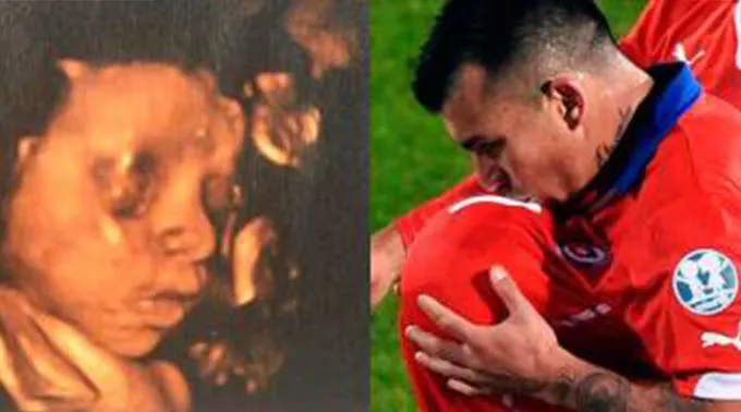 FutbolistaPelota_TwitterGaryMedel_240615A.jpg ?? 