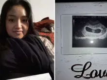 Liliana Mozo e o ultrassom do seu bebê. Fotos: SalvarEl1.