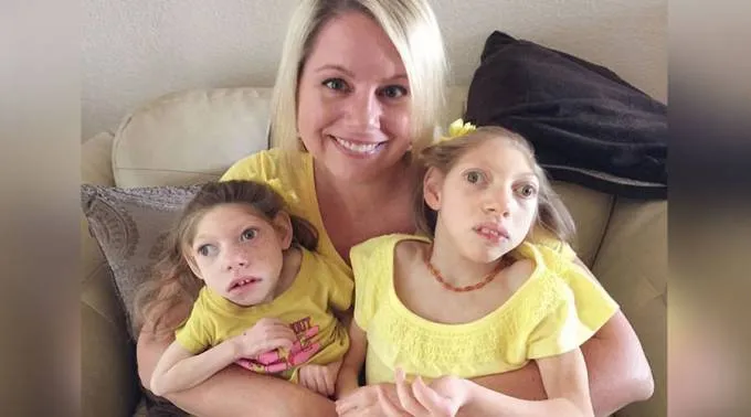 NinasMicrocefalia_FacebookGwenPohlenzHartley_100216.jpg ?? 