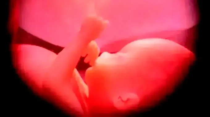 Nonacido_Wikipedia_040522.webp ?? 