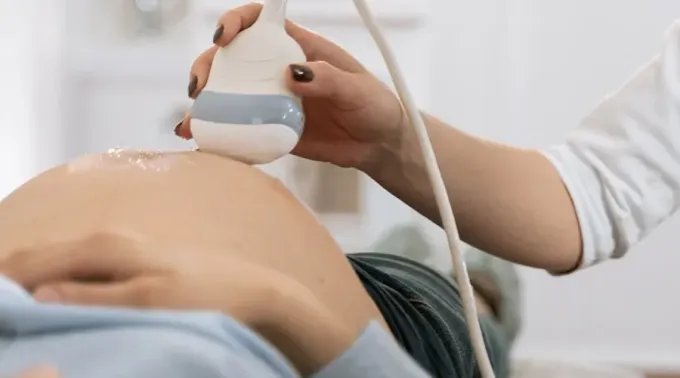 ObjecionConcieniaAborto_090721.webp ?? 