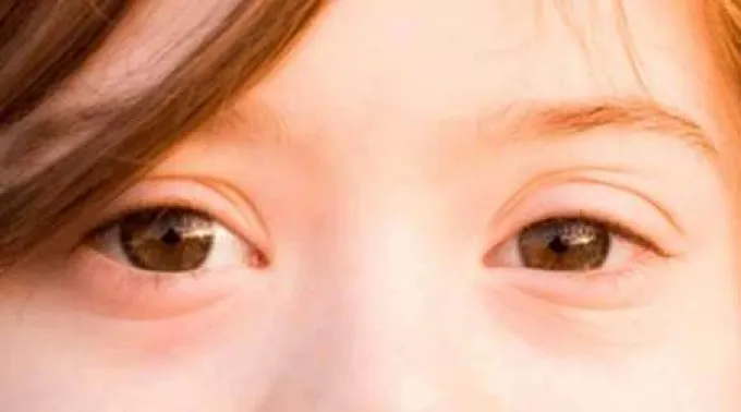 OjosSindromeDown_FlickrAndreas_PhotographyS_CCBY_NC--19022019.jpg ?? 