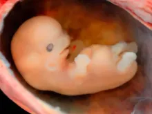 Embrião de 6 a 7 semanas.