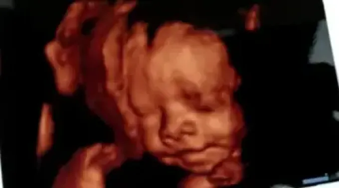 Ultrasonido-David-Ramos-ACI-061021.webp ?? 