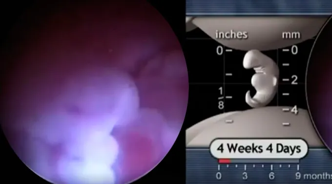 VideoFeto4Semanas_CapturaVideoFacebook_220616.jpg ?? 