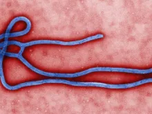 Virião do vírus Ebola.