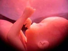 Imagem referencial. Crédito: Ivon19 (Wikipédia) CC-BY-SA-4.0